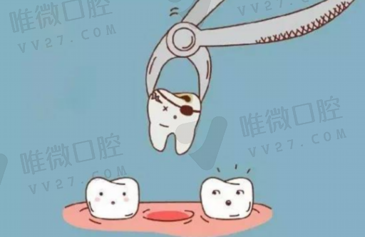 成都牙周治疗仪怎么收费的（牙周治疗仪的功能用途）(图1)